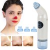 Vacuum Blackhead Removal Electric Pore Cleaner Blackhead Extractor Tool Face