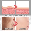 3Pcs EELHOE Collagen Boost Anti Aging Serum, EELHOE Anti-Wrinkle Cream,