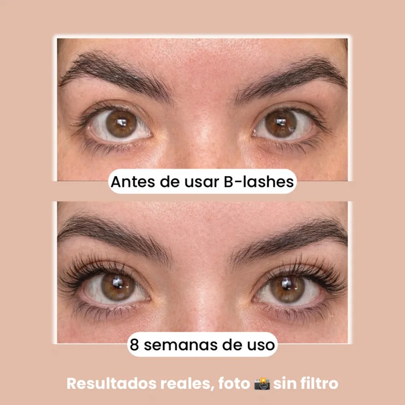 B-lashes Suero Crecimiento Pestañas Largas Origen Natural