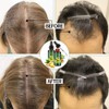 Lanthome Hair Growth Ginger Hair Nutrient Serum for Thinning Hair,
