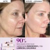Seyoul Mesowhite Crema Facial Para Cuidado Y Luminosidad