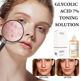 Glycolic Acid Toner,Glycolic Acid 7% The Exfoliating Toner,Skincare Hydrating Tone,for Combination Oily Skin,Exfoliate, Brighten Serum(240ml)