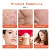 Portable High Frecuency Hi Frecuency Tipo Dermawand Profesional Spa Más