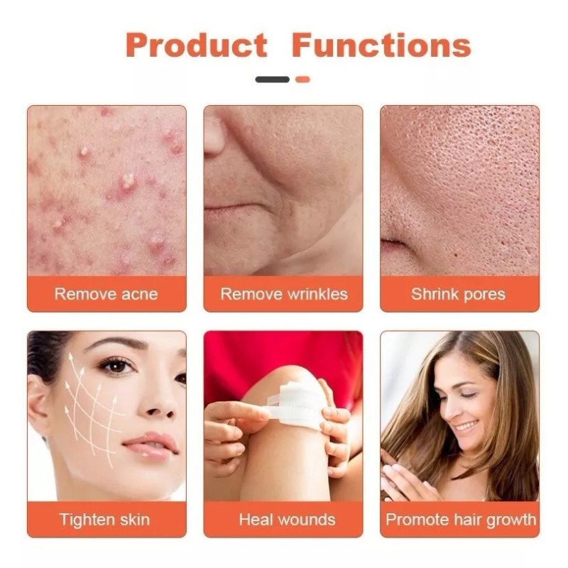 Portable High Frecuency Hi Frecuency Tipo Dermawand Profesional Spa Más