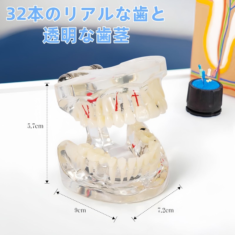 UKYCEORA Transparent Disease Teeth Model, Dental Implant Bridge Dental Teaching