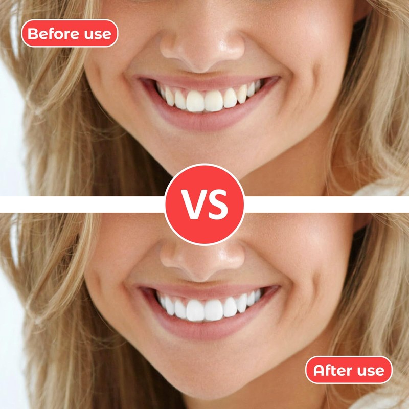 Pack of 100 Interdental Brushes, 4 Colour Set Interdental Brushes,