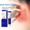 Anti Itch Cr/eam,Relieve Itching Cream for Skin,Anti Fungal Cream,Quickly Relieve