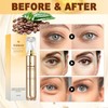 Caffeine Eye Serum, Under Eye Cream for Dark Circles and