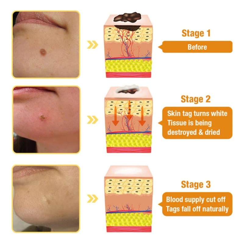 Creme De Tratamento Pele De Abelha,todas As Partes Do Co