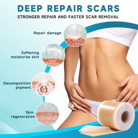 Silicone Scar Sheets, Silicone Scar Tape(1.8”x 157” Roll-4M), Silicone Scar Strips, Professional Scar Removal Sheets for Surgical Scars, Keloid, C-Section, Burn et