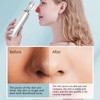 Blackhead Vacuum Suction Machine 3 Gears Magnify Pores Cleaning Electric