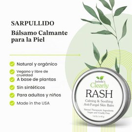 Isabella's Clearly RASH, Bálsamo Calmante para la Piel, Ayuda a Aliviar la Picazón, las Erupciones Cutáneas y la Piel Seca Irritada | Producto Natural