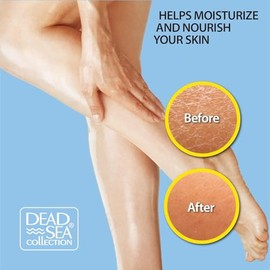 Dead Sea Collection Aceite corporal con colgeno  Hidratante para piel seca y aceite de masaje hidratante  Aceite de bao nutritivo  Aumenta la...      