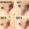 Bloomfall Clear Piercing Disc For Bump, Pressure Silicone Earrings For