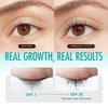 LASHVIEW Eyelash Growth Serum (0.17fl.oz / 5ml) - Premium Lash