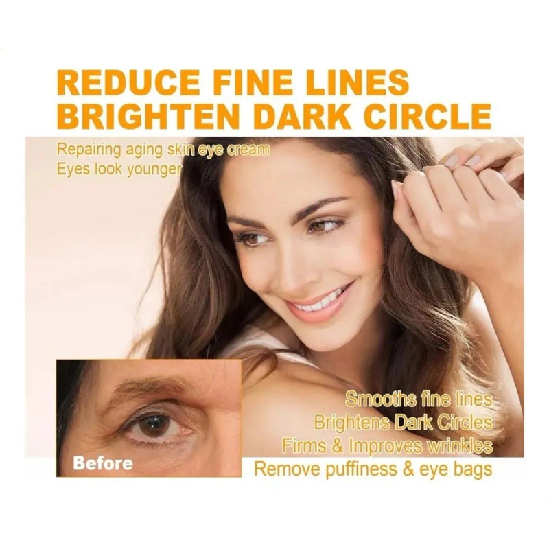 Crema Reafirmante Para Ojos, Elimina Bolsas Y Ojeras