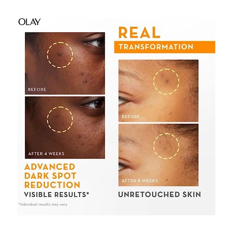 Olay Luminous Vitamin C Super Serum 30ml