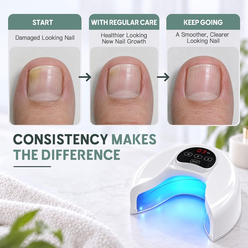 Nail Fungus Laser Device, Rechargeable for Multiple Fingernails & Toenails