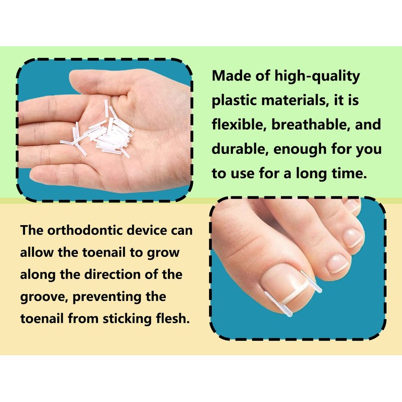 ZoeTekway Ingrown Toenails Set, Includes Ingrown Toenail Lifter Toenail Correction