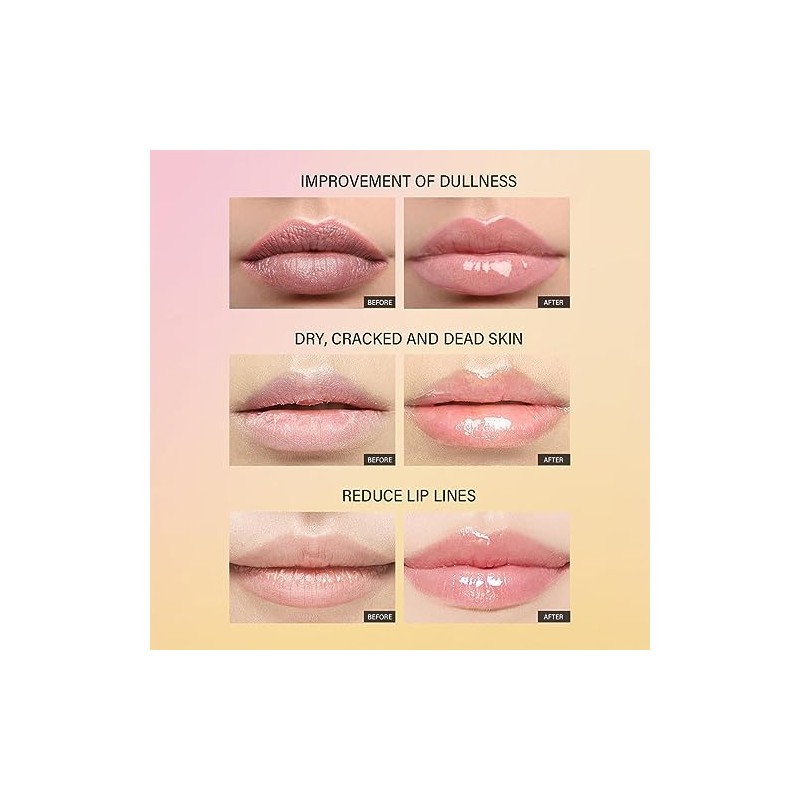 Littryee Gel Labial hidratante - Hidratante Labial para Labios Muy