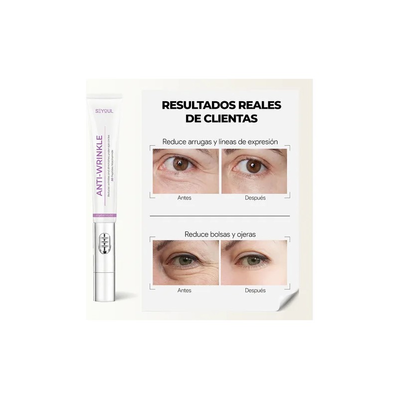 Seyoul Crema Para Ojos Hidratante Y Suavizante 20 G Todo