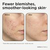 BHA Peeling 2% (100 ml) – Face Peel with BHA