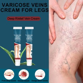 3PCS Varicose Veins Cream for Legs–Varicose Vein Foot Cream,Creams for Spider Vein,Spider Vein Remover,Deep R/elief Foot Creams,Lightweight Fast-Absorbing With Aloe Vera