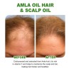 Mzl Aceite Capilar Amla Oil For Crecimiento Cabello