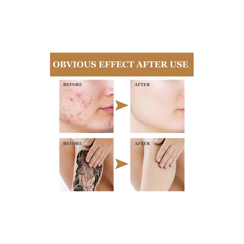 Kit Doble Cancelador Tatuaje Alta Cobertura Impermeable Neutra