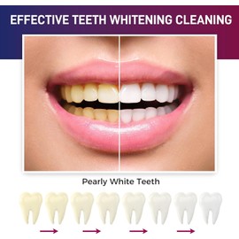 SoothPro Purple Teeth Whitening Gel: Tooth Stain Remover and Coffee Stain Remover 3PCS