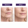 3D Lifting Night Cream with 17-Peptide for Wrinkles, 1.76 fl