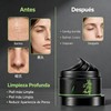 Kit de Mascarilla Eliminadora de Puntos Negros de Carbón