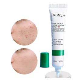 Crema Ácido Salicílico Bioaqua Control Acné Piel Grasa