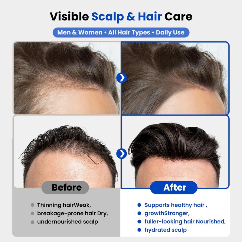GHK-Cu Copper Peptide Serum for Hair Growth & Scalp Care,