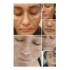 Anti-pigment Sérum Facial Anti-manchas