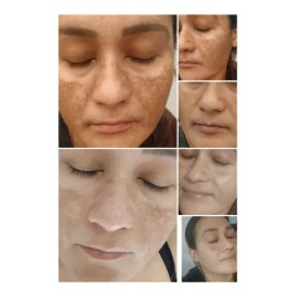Anti-pigment Sérum Facial Anti-manchas
