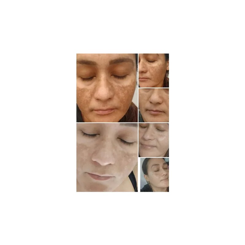 Anti-pigment Sérum Facial Anti-manchas