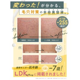 Retico Next Generation Retinol Beauty Serum, EW Essence I, Made in Japan, Sensitive Skin, High Penetration, Pores, Dullness, Firmness, 1.0 fl oz (30 ml)