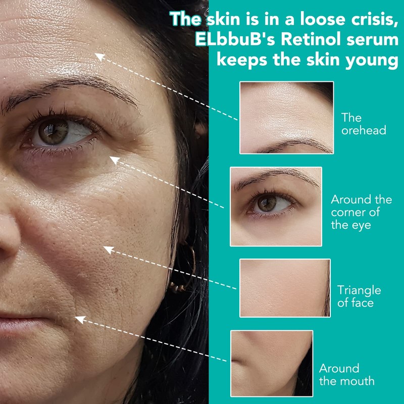 Retinol Serum Face with Retinol, Hyaluronic Acid and Vitamin E