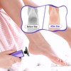 Inlisy 2 in 1 Professional Foot Callus Remover Rechargeable, 1000RPM