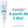 DUCRAY, Keracnyl Glycolic+ Crema Desincrustante, Disminuye Imperfecciones y Puntos Negros,