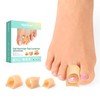 Welnove Hammertoe Corrector - 6 Pack Gel Toe Straighteners for