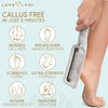 LOVE, LORI Foot Callus Remover - Pedicure Supplies Scrubber Dead