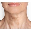 Dermactin-TS Crepe Be Gone Firming Neck and Decollete Cream 3