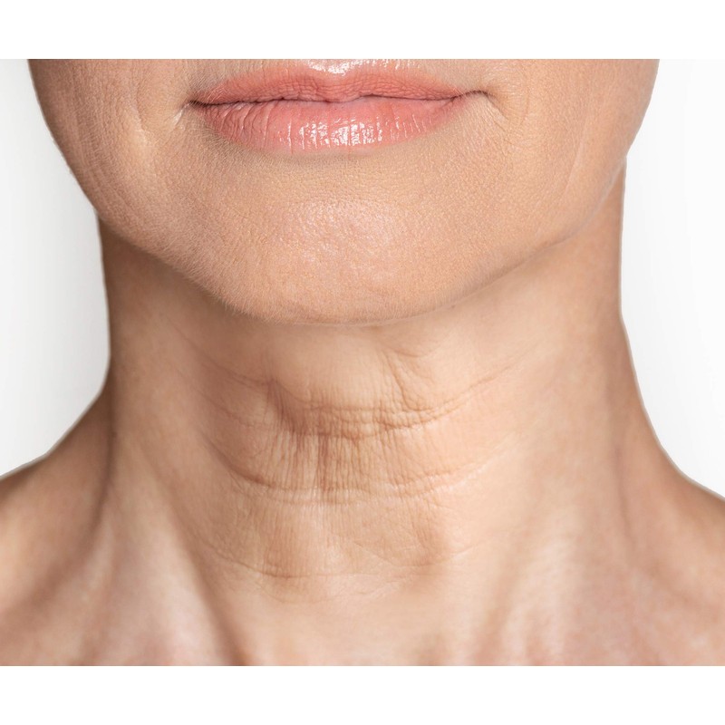 Dermactin-TS Crepe Be Gone Firming Neck and Decollete Cream 3