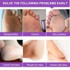 Mascarilla Exfoliante Para Pies De 3 Pares Para Piel Dura