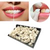 Resin Temporary Crown False Teeth Crown False Teeth Denture Care