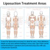 4 Pack Lipo Foam - Post Surgery Ab Board for
