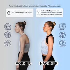 B-EASY Back Support Belt | Back Straightener | Posture Corrector Back for Men and Women | Back Brace Posture Corrector