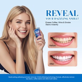 14 Paare Zahnaufhellung Whitening Strips,﻿Professional Zahnaufhellungsstreifen,Schonende Teeth Whitening Strips,Effektives und Schnell Bleaching für Weiße Zähne,Entfernt Flecken